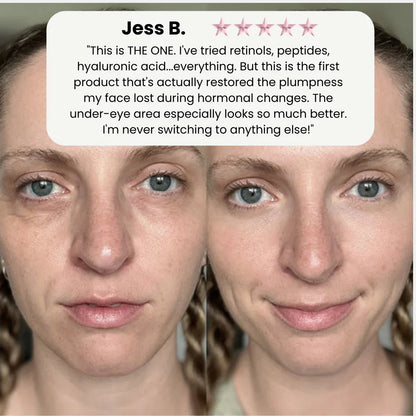 KAYŌMI SKIN™ - Korean Volufiline Collagen Serum