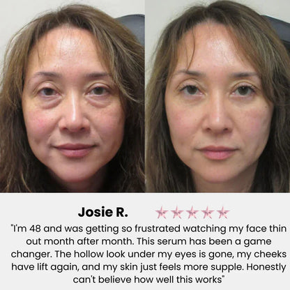 KAYŌMI SKIN™ - Korean Volufiline Collagen Serum